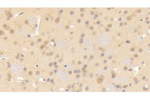Detection of CNTN3 in Mouse Cerebrum Tissue using Polyclonal Antibody to Contactin 3 (CNTN3) (CNTN3 抗体  (AA 264-493))