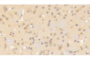 Detection of CNTN3 in Mouse Cerebrum Tissue using Polyclonal Antibody to Contactin 3 (CNTN3) (CNTN3 抗体  (AA 264-493))