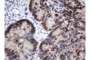Image no. 2 for anti-Methyltransferase Like 16 (METTL16) antibody (ABIN1499432) (METTL16 抗体)