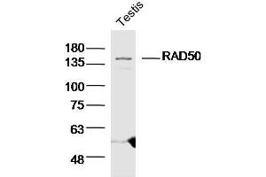Mouse testis lysates probed with RAD50 Polyclonal Antibody  at 1:300 overnight at 4°C followed by a conjugated secondary antibody for 60 minutes at 37°C. (RAD50 抗体  (AA 817-872))