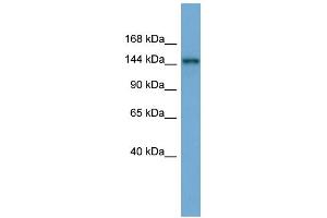 WB Suggested Anti-TEX14 Antibody Titration: 0. (TEX14 抗体  (Middle Region))