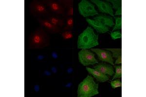 ABIN7093617 and ABIN7097642 staining  cells by IF/ICC.