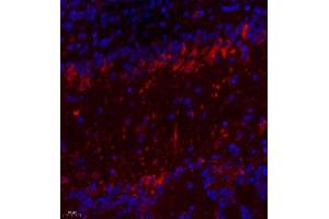 Immunofluorescence of paraffin embedded mouse prefrontal lobe using TTC33 (ABIN7075871) at dilution of 1: 650 (400x lens) (TTC33 抗体)