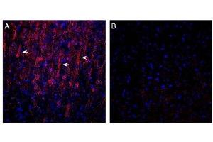 Expression of GPR183 in in rat parietal cortex. (GPR183 抗体  (Extracellular))
