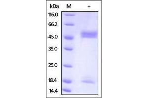 Mouse FcRn / FCGRT & B2M on SDS-PAGE under reducing (R) condition. (FcRn Protein (AA 22-297) (His tag,Strep Tag))
