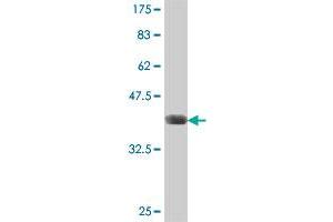 Western Blot detection against Immunogen (37 KDa) . (TSEN34 抗体  (AA 1-99))