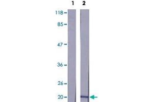 Western blot analysis of extracts from K-562 cells using MYL12A polyclonal antibody . (MYL12A 抗体  (Ser18))