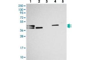 Western blot analysis of Lane 1: RT-4, Lane 2: U-251 MG, Lane 3: Human Plasma, Lane 4: Liver, Lane 5: Tonsil with CHID1 polyclonal antibody . (CHID1 抗体)
