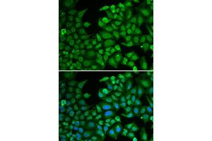 Immunofluorescence analysis of MCF-7 cells using RBFOX3 antibody (ABIN5970347). (NeuN 抗体)