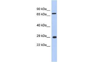Human Muscle; WB Suggested Anti-AKTIP Antibody Titration: 0. (AKTIP 抗体  (Middle Region))