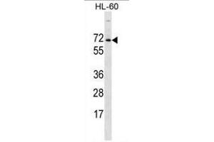 ACPL2 Antibody (Center) western blot analysis in HL-60 cell line lysates (35 µg/lane). (ACPL2 抗体  (Middle Region))