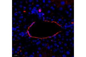 Immunofluorescence (Paraffin-embedded Sections) (IF (p)) image for anti-Rh Blood Group, D Antigen (RHD) antibody (ABIN7075412)