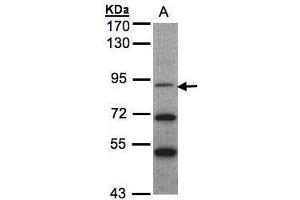 Western Blotting (WB) image for anti-Neurotrophic tyrosine Kinase, Receptor, Type 3 (NTRK3) (Internal Region) antibody (ABIN2855417)