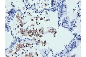 Immunohistochemistry (IHC) image for anti-rho GTPase Activating Protein 25 (ARHGAP25) antibody (ABIN1496701) (ARHGAP25 抗体)