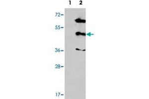 Western blot analysis of MAPK12 (arrow) using MAPK12 polyclonal antibody . (MAPK12 抗体  (Internal Region))