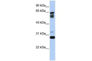 TMEM187 antibody used at 1 ug/ml to detect target protein. (TMEM187 抗体  (Middle Region))