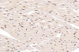 Immunohistochemistry analysis of paraffin-embedded rat heart using,ZBTB20 (ABIN7076248) at dilution of 1: 12000 (ZBTB20 抗体)