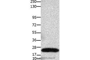 Western blot analysis of Human colon cancer tissue, using CLDN3 Polyclonal Antibody at dilution of 1:550 (Claudin 3 抗体)