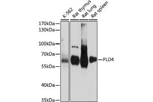 Western blot analysis of extracts of various cell lines, using PLD4 antibody (ABIN7269353) at 1:1000 dilution. (Phospholipase D4 抗体  (AA 52-200))