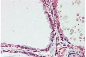 Human Thyroid: Formalin-Fixed, Paraffin-Embedded (FFPE) (Aconitase 1 抗体  (N-Term))