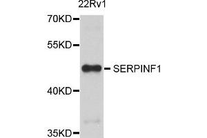 Western blot analysis of extract of 22Rv1 cells, using SERPINF1 antibody. (PEDF 抗体)