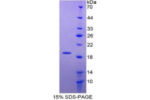 SDS-PAGE analysis of Mouse SOD1 Protein.