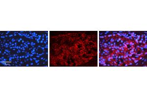 Rabbit Anti-NFKBIB Antibody   Formalin Fixed Paraffin Embedded Tissue: Human Testis Tissue Observed Staining: Nucleus, Cytoplasm Primary Antibody Concentration: 1:100 Other Working Concentrations: N/A Secondary Antibody: Donkey anti-Rabbit-Cy3 Secondary Antibody Concentration: 1:200 Magnification: 20X Exposure Time: 0. (NFKBIB 抗体  (Middle Region))