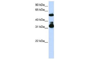Western Blotting (WB) image for anti-F-Box and WD Repeat Domain Containing 2 (FBXW2) antibody (ABIN2458706) (FBXW2 抗体)