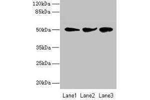 Western blot All lanes: NIM1K antibody at 2 μg/mL Lane 1: Jurkat whole cell lysate Lane 2: HepG2 whole cell lysate Lane 3: COLO205 whole cell lysate Secondary Goat polyclonal to rabbit IgG at 1/10000 dilution Predicted band size: 50 kDa Observed band size: 50 kDa