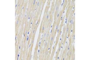 Immunohistochemistry of paraffin-embedded rat heart using FIS1 Antibody.