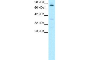 WB Suggested Anti-FOXE3 Antibody Titration:  0. (FOXE3 抗体  (C-Term))