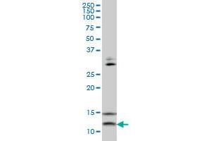 VAMP1 monoclonal antibody (M02), clone 5A4 Western Blot analysis of VAMP1 expression in HepG2 . (VAMP1 抗体  (AA 28-96))