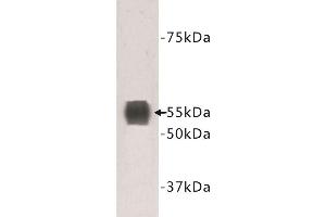Western Blotting (WB) image for anti-Transmembrane Protein 132A (TMEM132A) antibody (ABIN1854988) (TMEM132A 抗体)