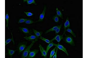 Immunofluorescent analysis of Hela cells using ABIN7143637 at dilution of 1:100 and Alexa Fluor 488-congugated AffiniPure Goat Anti-Rabbit IgG(H+L) (AKR1A1 抗体  (AA 2-325))