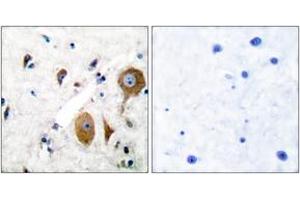 Immunohistochemistry analysis of paraffin-embedded human brain tissue, using mGluR8 Antibody. (GRM8 抗体  (AA 841-890))