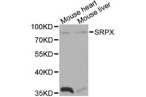 Western blot analysis of extracts of various cell lines, using SRPX antibody. (SRPX 抗体)