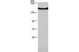 Western Blot analysis of Mouse bladder tissue using GPR124 Polyclonal Antibody at dilution of 1:300 (GPR124 抗体)
