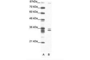 Image no. 1 for anti-PBX/knotted 1 Homeobox 2 (PKNOX2) (N-Term) antibody (ABIN202209) (PKNOX2 抗体  (N-Term))