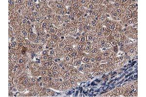 Immunohistochemical staining of paraffin-embedded Human liver tissue using anti-ACOT12 mouse monoclonal antibody. (ACOT12 抗体)