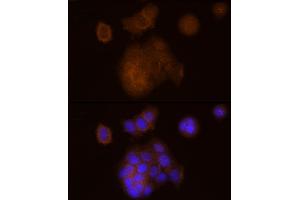 Immunofluorescence analysis of MCF7 cells using SOCS1 Rabbit mAb (ABIN7270640) at dilution of 1:100 (40x lens). (SOCS1 抗体)