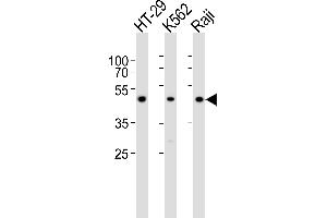 Western Blotting (WB) image for anti-Interleukin 13 Receptor, alpha 1 (IL13RA1) (AA 207-238), (C-Term) antibody (ABIN6242399)