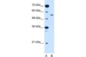 WB Suggested Anti-SLC2A10 Antibody Titration:  2.