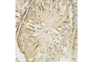 Immunohistochemistry (Paraffin-embedded Sections) (IHC (p)) image for anti-Tropomyosin-2 (TPM2) antibody (ABIN3017365)