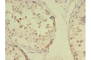 Immunohistochemistry (IHC) image for anti-RNA Binding Motif Protein, Y-Linked, Family 1, Member F (RBMY1F) (AA 1-496) antibody (ABIN7168313)