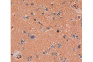Used in DAB staining on fromalin fixed paraffin- embedded Kidney tissue (CHODL 抗体  (AA 48-214))