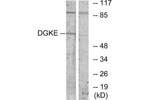 Western Blotting (WB) image for anti-Diacylglycerol Kinase, epsilon 64kDa (DGKE) (Internal Region) antibody (ABIN1849432) (DGKE 抗体  (Internal Region))