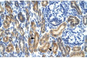 Rabbit Anti-HCLS1 Antibody ,Paraffin Embedded Tissue: Human Kidney  Cellular Data: Epithelial cells of renal tubule  Antibody Concentration: 4. (HCLS1 抗体  (N-Term))