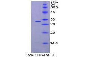 SDS-PAGE analysis of Rat Ribonuclease Inhibitor Protein. (RNH1 蛋白)