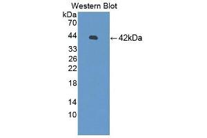 Detection of Recombinant SYT1, Human using Polyclonal Antibody to Synaptotagmin I (SYT1) (SYT1 抗体  (AA 136-422))