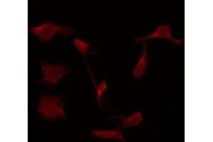 ABIN6276058 staining Hela by IF/ICC. (TACR1 抗体  (Internal Region))